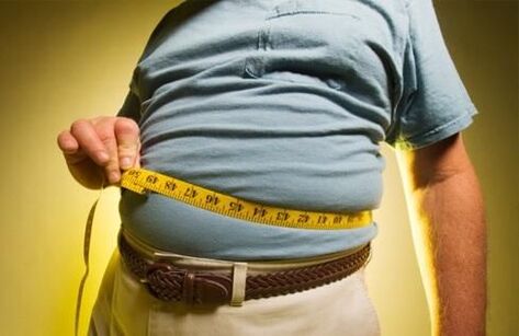 Aşırı kilo, varisli damarların gelişimini tetikler